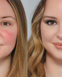 I do a Subscribers Make Up! Rosacea, Sensitive Skin and the Power of Make Up