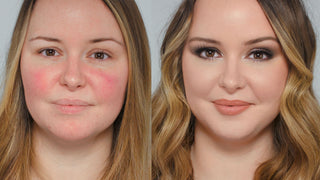 I do a Subscribers Make Up! Rosacea, Sensitive Skin and the Power of Make Up I do a Subscribers Make Up! Rosacea, Sensitive Skin and the Power of Make Up