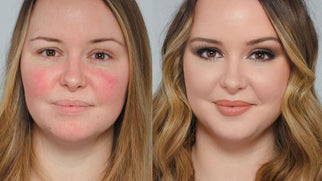 I do a Subscribers Make Up! Rosacea, Sensitive Skin and the Power of Make Up I do a Subscribers Make Up! Rosacea, Sensitive Skin and the Power of Make Up