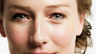 Puffiness & Bags Under The Eyes - Causes and Treatments Puffiness & Bags Under The Eyes - Causes and Treatments