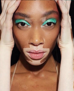 Byblos Fashion Show - Winnie Harlow Byblos Fashion Show - Winnie Harlow