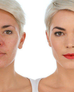 Makeup Tips for Redness and Rosacea plus a Simple Statement Makeup
