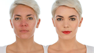 Makeup Tips for Redness and Rosacea plus a Simple Statement Makeup Makeup Tips for Redness and Rosacea plus a Simple Statement Makeup