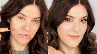 3 Tactics for Dealing with a Large Swollen Blemish 3 Tactics for Dealing with a Large Swollen Blemish